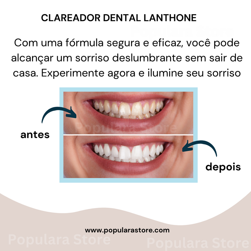 Clareador Dental em Mousse - Lanthone